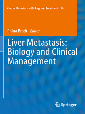 cover image of Liver Metastasis